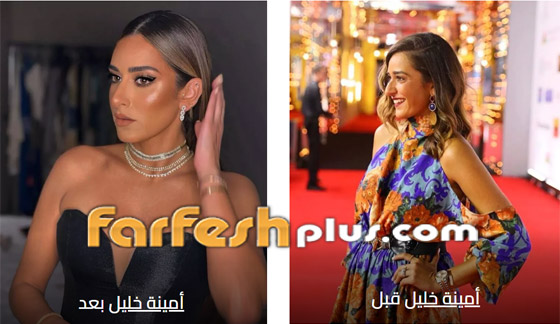 صور أمينة خليل قبل وبعد: هل أجرت عملية تجميل جديدة في أنفها؟ صورة رقم 1