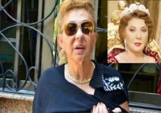 صور نجمات الفن قبل وبعد عمليات التجميل.. البعض تشوه وجههن! صورة رقم 2