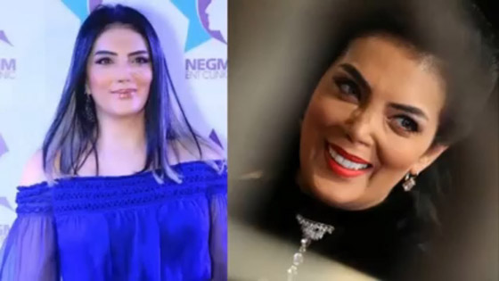 صور نجمات الفن قبل وبعد عمليات التجميل.. البعض تشوه وجههن! صورة رقم 3