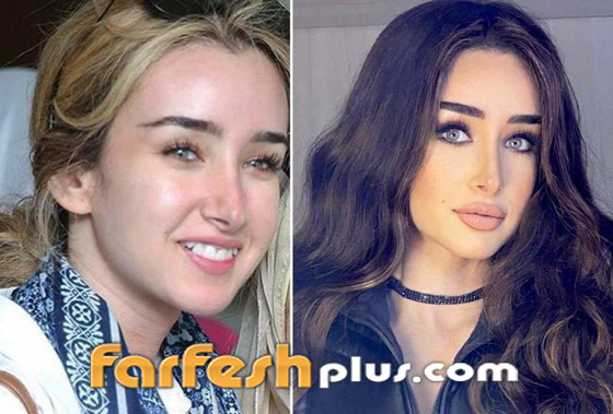 تسريب صورة الفنانة هنا الزاهد قبل عمليات التجميل والشهرة.. لن تتخيل كيف كانت! صورة رقم 4