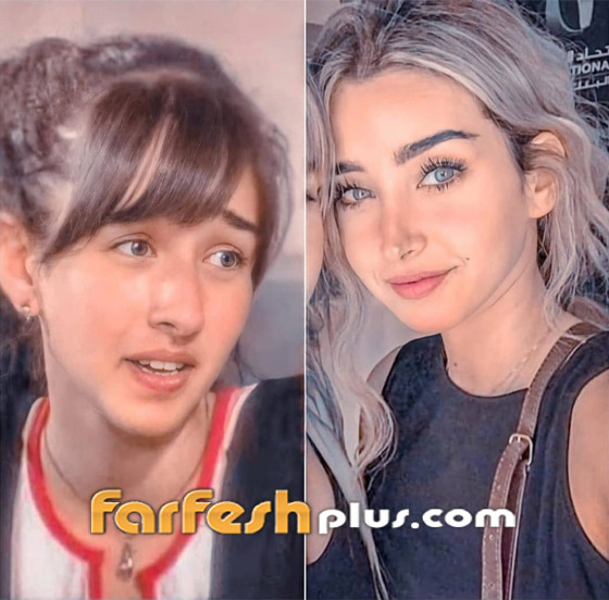 تسريب صورة الفنانة هنا الزاهد قبل عمليات التجميل والشهرة.. لن تتخيل كيف كانت! صورة رقم 5