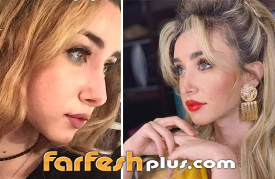 تسريب صورة الفنانة هنا الزاهد قبل عمليات التجميل والشهرة.. لن تتخيل كيف كانت! صورة رقم 6