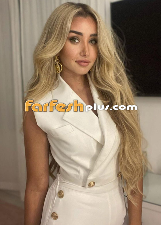 تسريب صورة الفنانة هنا الزاهد قبل عمليات التجميل والشهرة.. لن تتخيل كيف كانت! صورة رقم 17