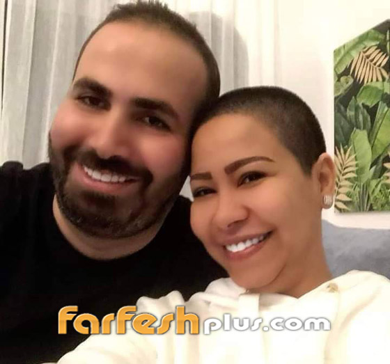 فيديو وصور صادمة: شيرين بدون شعر ومصدر يؤكد: حسام حبيب ضربها وحلق شعرها زيرو! صورة رقم 1