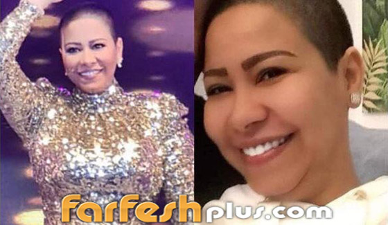 فيديو وصور صادمة: شيرين بدون شعر ومصدر يؤكد: حسام حبيب ضربها وحلق شعرها زيرو! صورة رقم 8