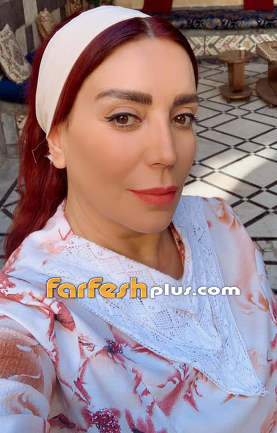 شكران مرتجى ترد ردا ناريا على متنمر سخر من أنفها قبل التجميل صورة رقم 7