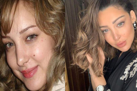 نجوم ستار أكاديمي بين الماضي والحاضر.. هل تغيرت أشكالهم كثيراً؟ صورة رقم 5