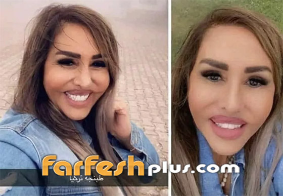 صور صادمة: الفنانة مها المصري بوجه مشوه بعد عملية تجميل جديدة والجمهور: يكسر ايدين الدكتور! صورة رقم 3
