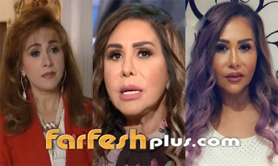 صور صادمة: الفنانة مها المصري بوجه مشوه بعد عملية تجميل جديدة والجمهور: يكسر ايدين الدكتور! صورة رقم 4