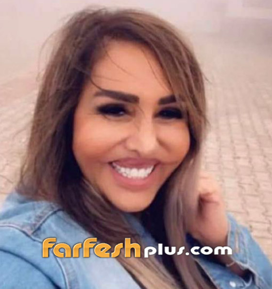 صور صادمة: الفنانة مها المصري بوجه مشوه بعد عملية تجميل جديدة والجمهور: يكسر ايدين الدكتور! صورة رقم 2