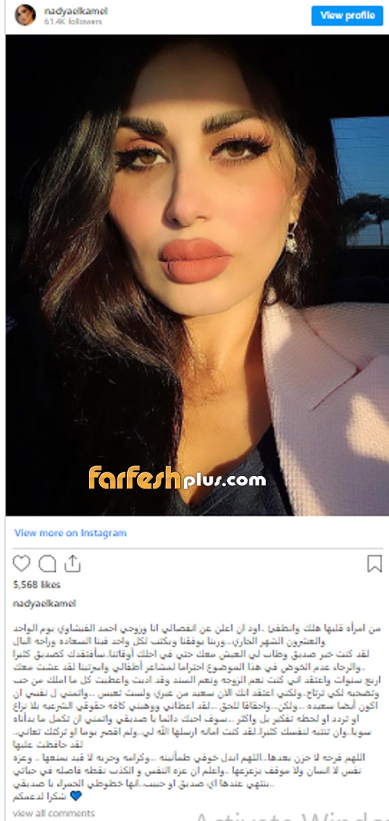 زوجات مشاهير يفضحن المستور بعد الطلاق بينهن طليقة احمد الفيشاوي، مصطفى فهمي ومي حلمي! صورة رقم 1