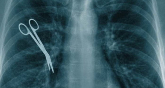 تعيش مع مقص جراحي في بطنها لمدة 20 عاماً صورة رقم 7