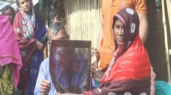 تعيش مع مقص جراحي في بطنها لمدة 20 عاماً صورة رقم 2