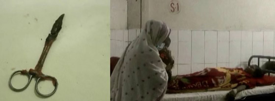 تعيش مع مقص جراحي في بطنها لمدة 20 عاماً صورة رقم 6