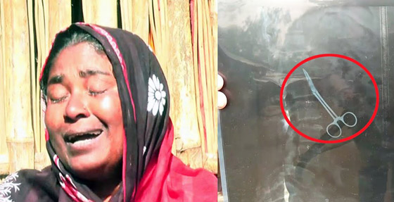 تعيش مع مقص جراحي في بطنها لمدة 20 عاماً صورة رقم 1