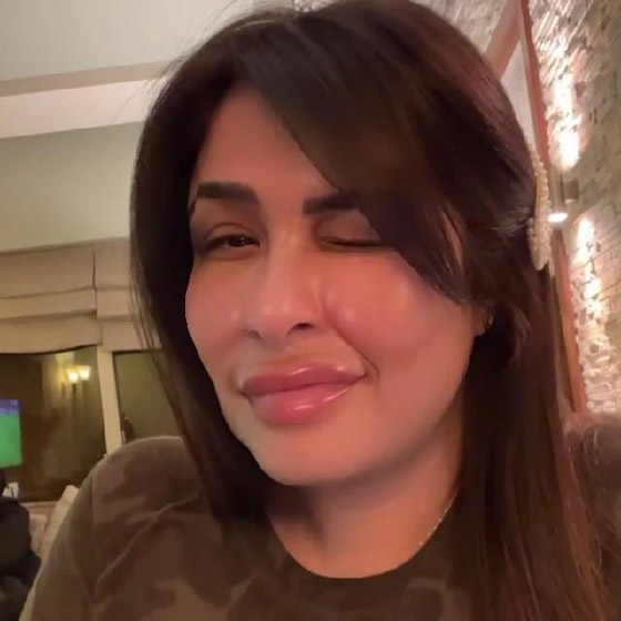 ما سر عملية التجميل التي أجرتها ياسمين عبدالعزيز وغيرت ملامحها؟ صورة رقم 2