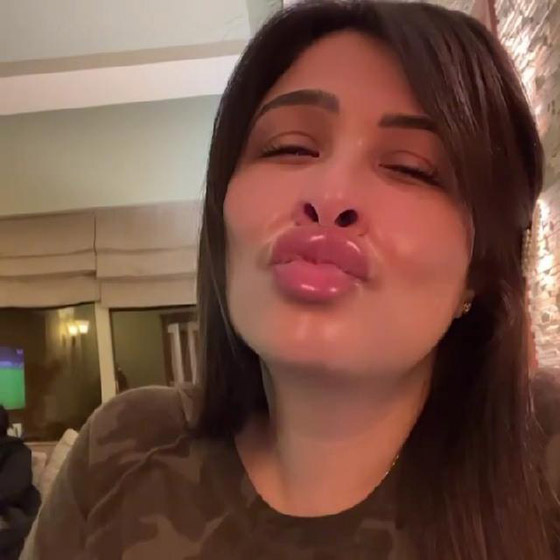 ما سر عملية التجميل التي أجرتها ياسمين عبدالعزيز وغيرت ملامحها؟ صورة رقم 3