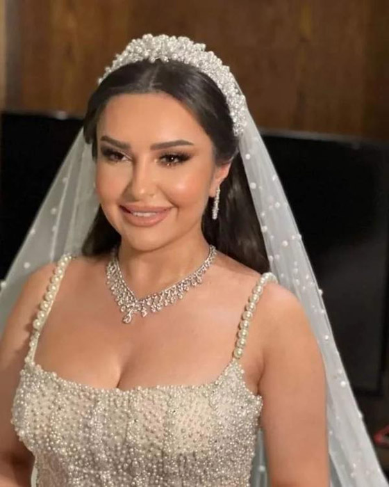 فيديو وصور مميّزة من حفل زفاف الفنانة السورية شهد برمدا صورة رقم 7