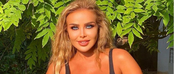 5 نجمات اعترفن بندمهن بعد خضوعهن لعمليات تجميل صورة رقم 5