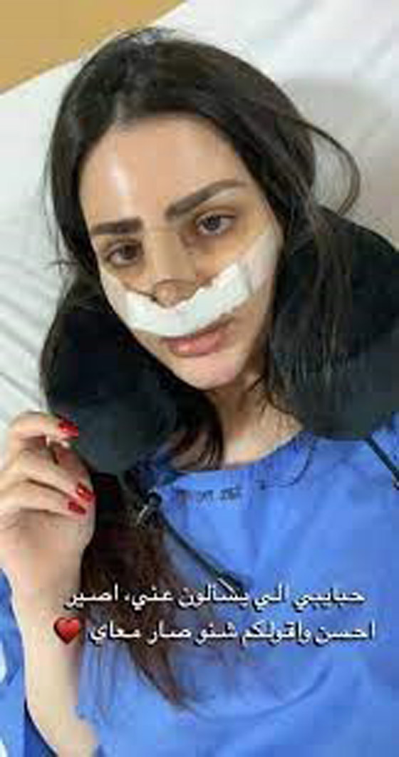 قائمة بالمشاهير الذين خضعوا لعمليات تجميل في 2022 صورة رقم 3