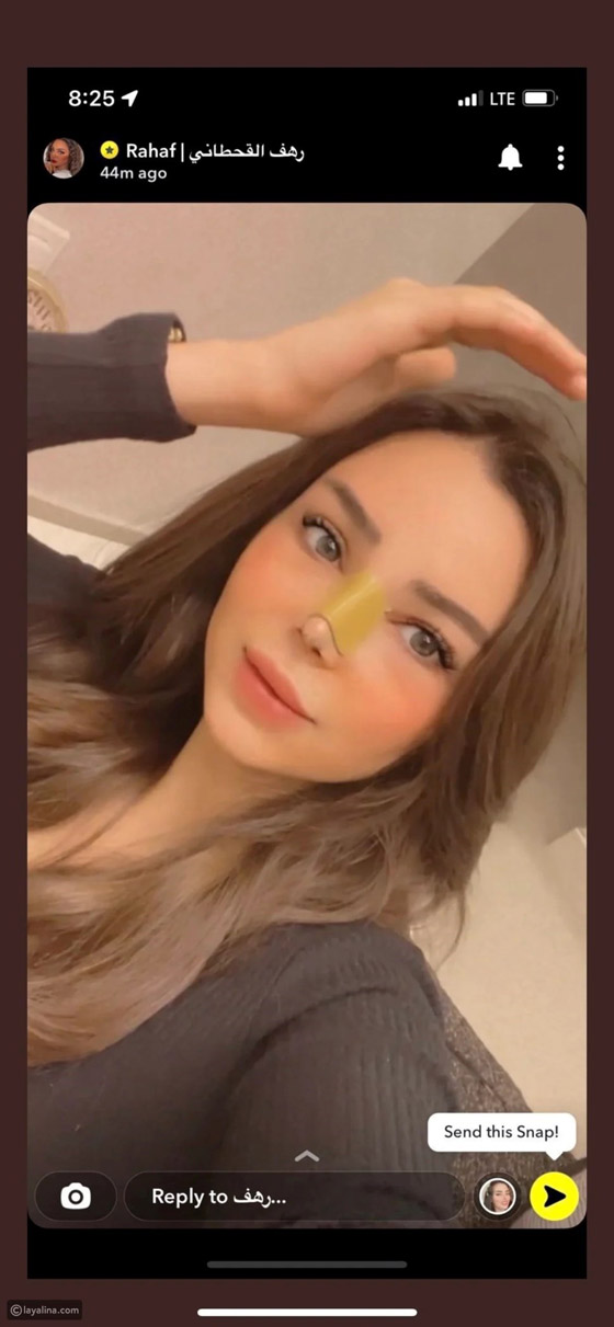 قائمة بالمشاهير الذين خضعوا لعمليات تجميل في 2022 صورة رقم 6