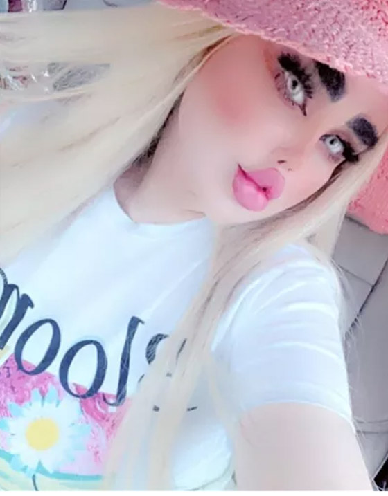 صور داليا نعيم العراقية تصدم المتابعين بعد عملية تجميل جديدة! صورة رقم 1