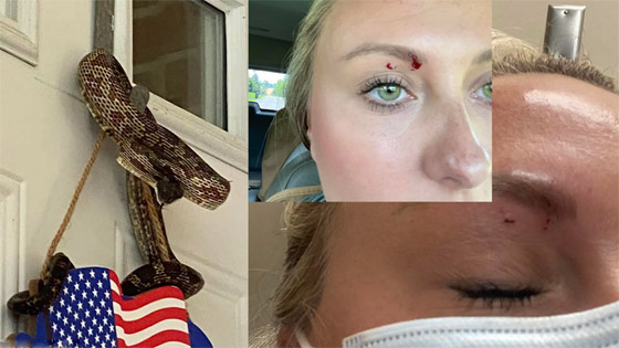 حادثة غريبة.. ثعبان يلدغ سيدة في عينها! صور صورة رقم 1