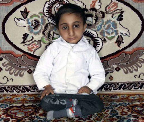 طوله 64.7 سنتيمتر.. شاب إيراني يستعد للقب أقصر رجل في العالم صورة رقم 7