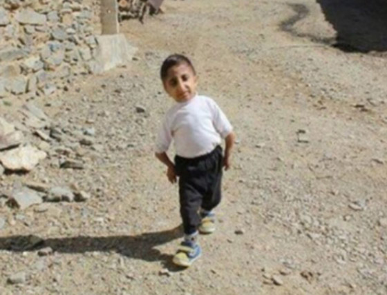 طوله 64.7 سنتيمتر.. شاب إيراني يستعد للقب أقصر رجل في العالم صورة رقم 9