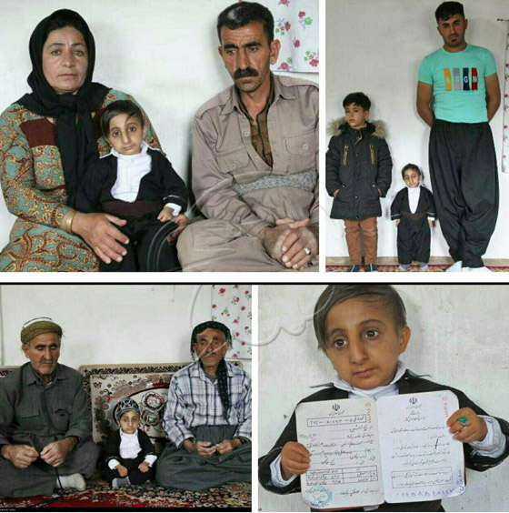 طوله 64.7 سنتيمتر.. شاب إيراني يستعد للقب أقصر رجل في العالم صورة رقم 12