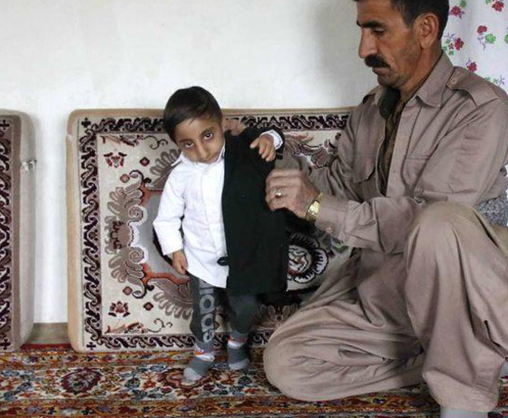 طوله 64.7 سنتيمتر.. شاب إيراني يستعد للقب أقصر رجل في العالم صورة رقم 11