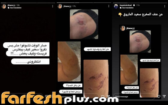 صور صادمة: طليقة سعيد الماروق تفضحه: أكل لحمي بأسنانه وضربني بقسوة وأسال دمي! صورة رقم 7