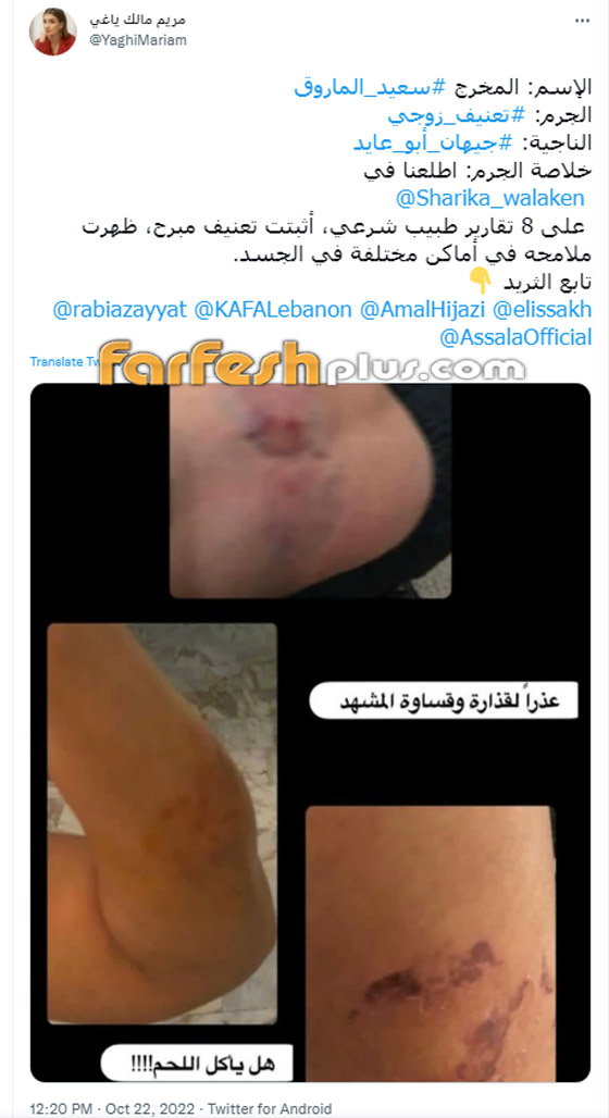 صور صادمة: طليقة سعيد الماروق تفضحه: أكل لحمي بأسنانه وضربني بقسوة وأسال دمي! صورة رقم 4