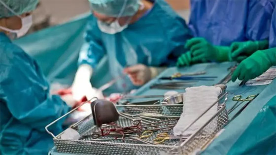 حالة نادرة جدا.. ولادة طفل يحمل توأمه في بطنه! صورة رقم 2