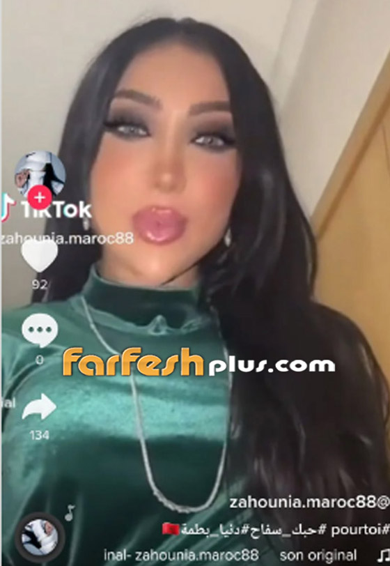محمد الترك يسخر من وجه طليقته دنيا بطمة المثلث ويشبهه بعضو بجسمه! فيديو وصور صورة رقم 5