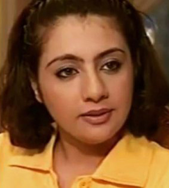 صور: نجمات بعد عمليات التجميل أصبحن كأنهن نسخة واحدة! صورة رقم 5 صور: نجمات بعد عمليات التجميل أصبحن كأنهن نسخة واحدة! صورة رقم 5