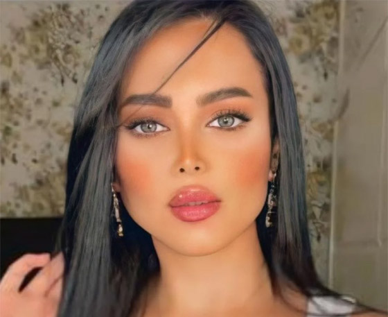 صور: نجمات بعد عمليات التجميل أصبحن كأنهن نسخة واحدة! صورة رقم 12 صور: نجمات بعد عمليات التجميل أصبحن كأنهن نسخة واحدة! صورة رقم 12