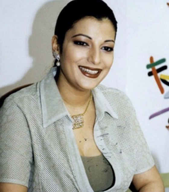 صور: نجمات بعد عمليات التجميل أصبحن كأنهن نسخة واحدة! صورة رقم 9 صور: نجمات بعد عمليات التجميل أصبحن كأنهن نسخة واحدة! صورة رقم 9