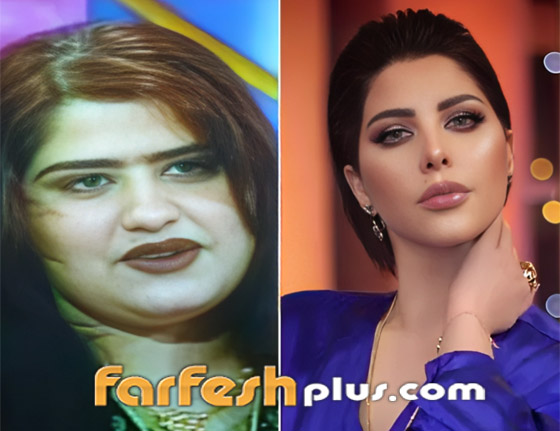 صور نجمات الكويت قبل وبعد عمليات التجميل: لن تصدق التغيير! صورة رقم 3