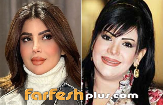صور نجمات الكويت قبل وبعد عمليات التجميل: لن تصدق التغيير! صورة رقم 4