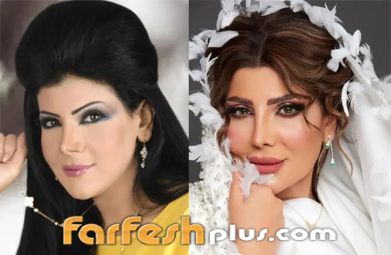 صور نجمات الكويت قبل وبعد عمليات التجميل: لن تصدق التغيير! صورة رقم 18