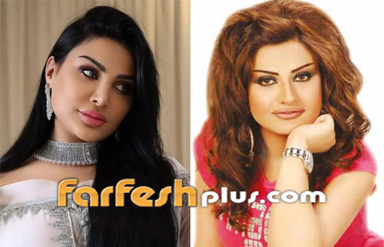 صور نجمات الكويت قبل وبعد عمليات التجميل: لن تصدق التغيير! صورة رقم 5