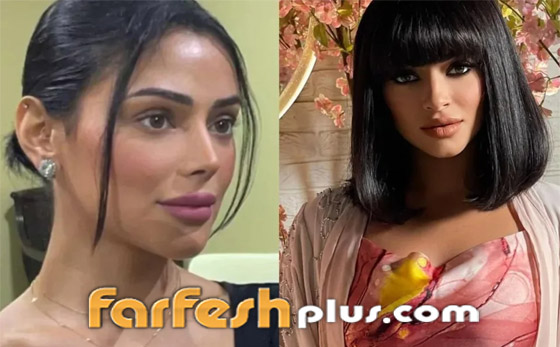 صور نجمات الكويت قبل وبعد عمليات التجميل: لن تصدق التغيير! صورة رقم 10