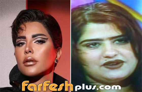 صور نجمات الكويت قبل وبعد عمليات التجميل: لن تصدق التغيير! صورة رقم 16