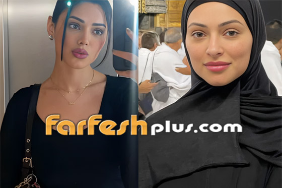 صور نجمات الكويت قبل وبعد عمليات التجميل: لن تصدق التغيير! صورة رقم 25