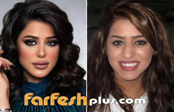 صور نجمات الكويت قبل وبعد عمليات التجميل: لن تصدق التغيير! صورة رقم 11