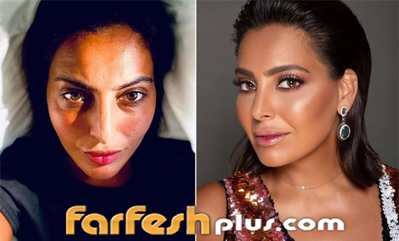 صور نجمات الكويت قبل وبعد عمليات التجميل: لن تصدق التغيير! صورة رقم 7