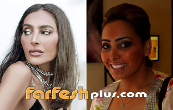 صور نجمات الكويت قبل وبعد عمليات التجميل: لن تصدق التغيير! صورة رقم 21