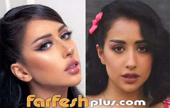 صور نجمات الكويت قبل وبعد عمليات التجميل: لن تصدق التغيير! صورة رقم 23