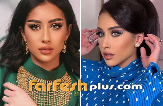 صور نجمات الكويت قبل وبعد عمليات التجميل: لن تصدق التغيير! صورة رقم 24